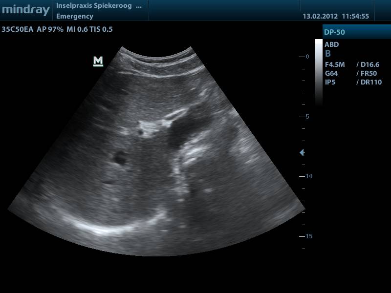 Sonografie Beispielbild